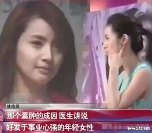 林依晨|终于怀了！备孕7年，娱乐圈集体祝福