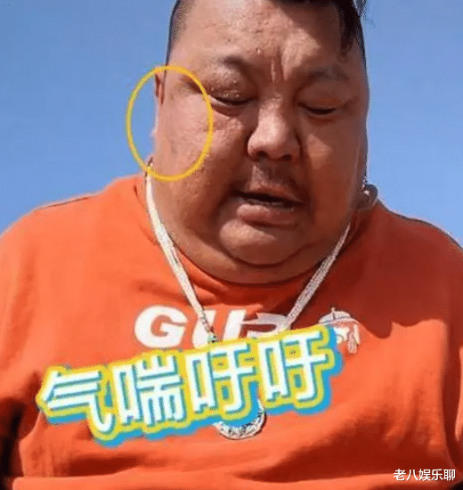 30岁恩克近400斤,开拖拉机肚子被卡住,网友:泡泡龙在等他