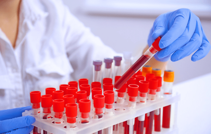 经络穴位理论敷熨|肌酐升高后预示着病情越来越差吗？2种情况不用担心尿毒症