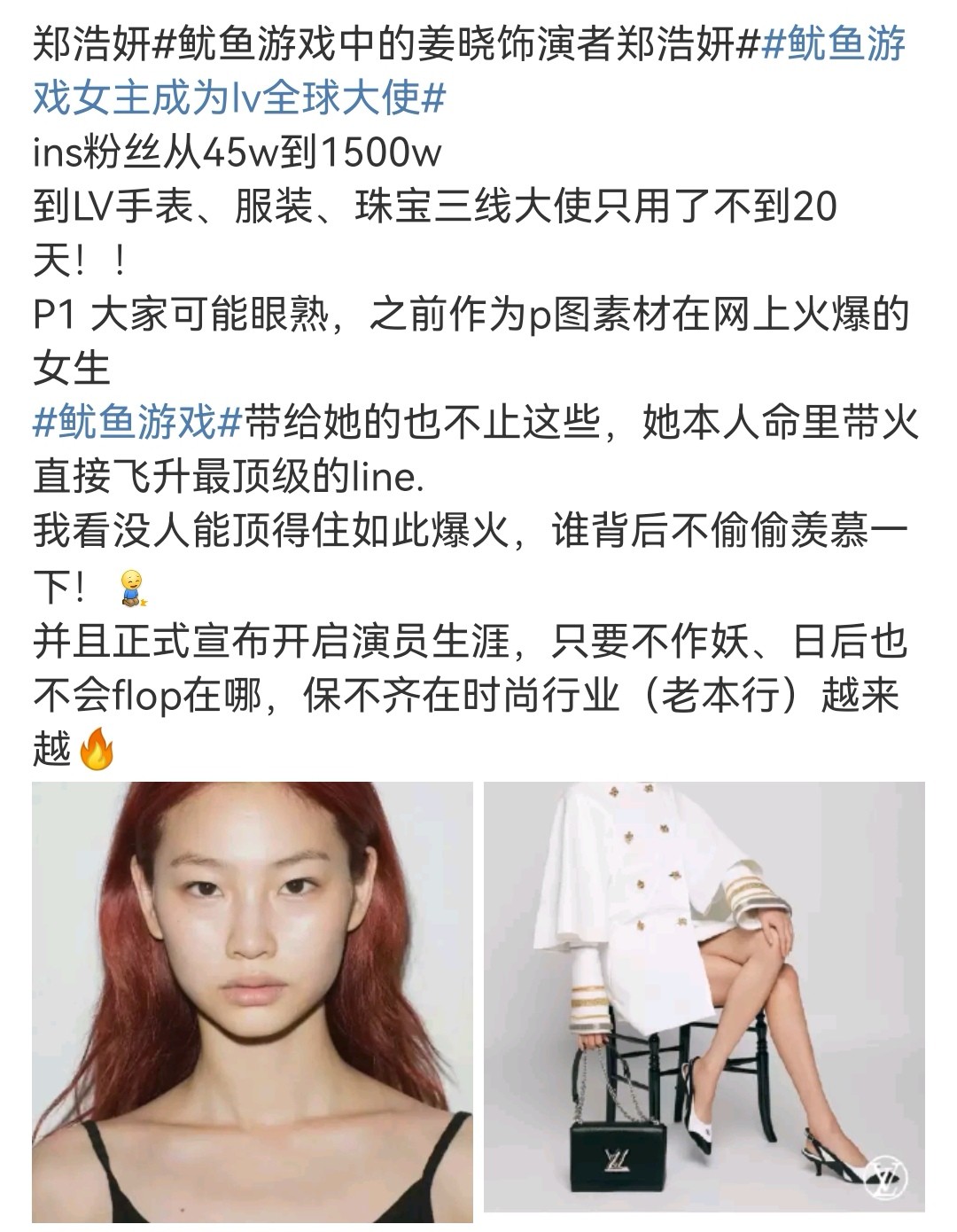 肖战|无海外出道经历的肖战拿下顶奢，国际名人点赞，被认可的东方面孔