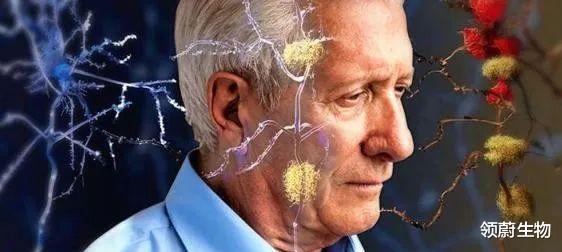 神经退行性疾病 临床试验汇总丨干细胞修复神经功能，为神经退行性疾病开辟新途径