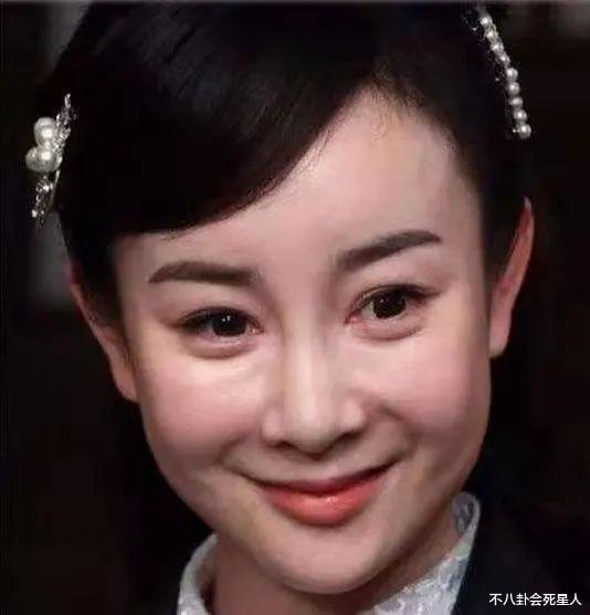 袁姗姗|华鼎奖上袁姗姗大变样，山根太高鼻翼很宽，女星动鼻需谨慎