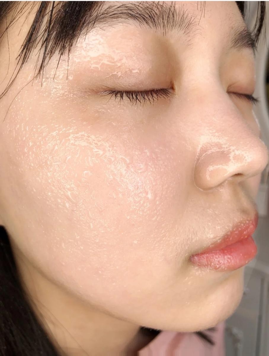 护肤|为什么你的皮肤越护理越糙？可能踩了这5个护肤误区，你中了几个