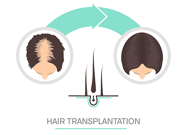 脱发|头发稀少怎么变浓密？