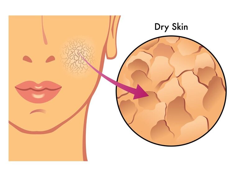 疾病|脸上皱纹多因2种原因！5类食物堪称“皱纹熨斗”，谁吃谁知道