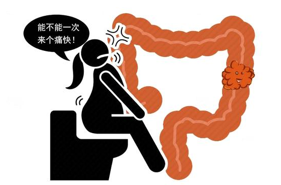 肠癌|排大便时，总是前端硬后面软，是肠癌吗？医生为你解惑，不妨看看