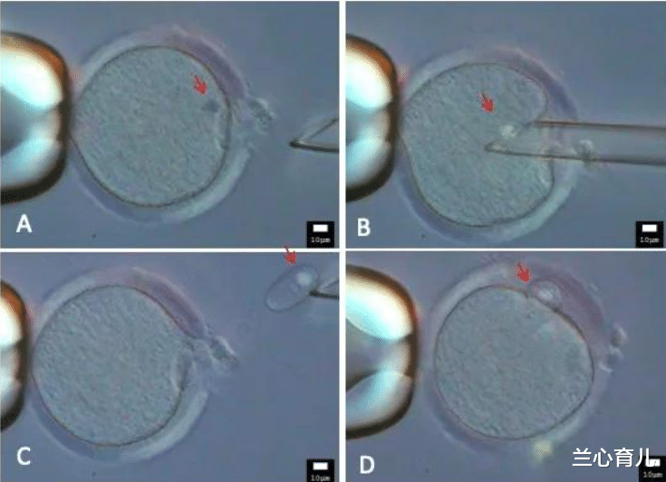 兰心育儿|科学家培养出“三亲婴儿”,含三人DNA,跟普通婴儿有什么区别?