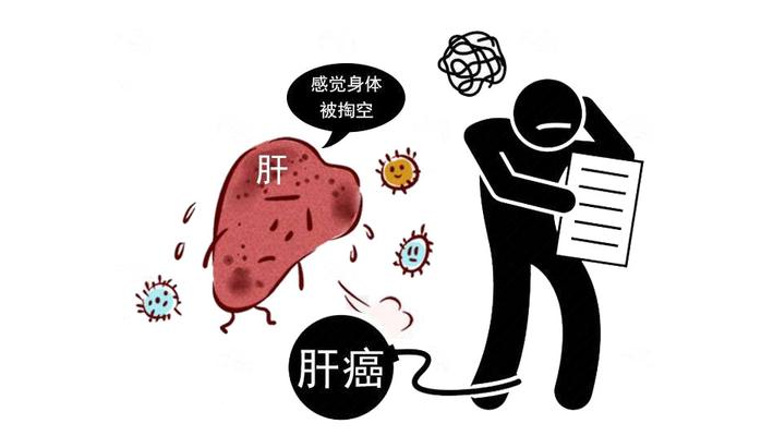 医生胡侃|肝癌到来毫无迹象？2个症状若能早点读懂，尽快检查排查！