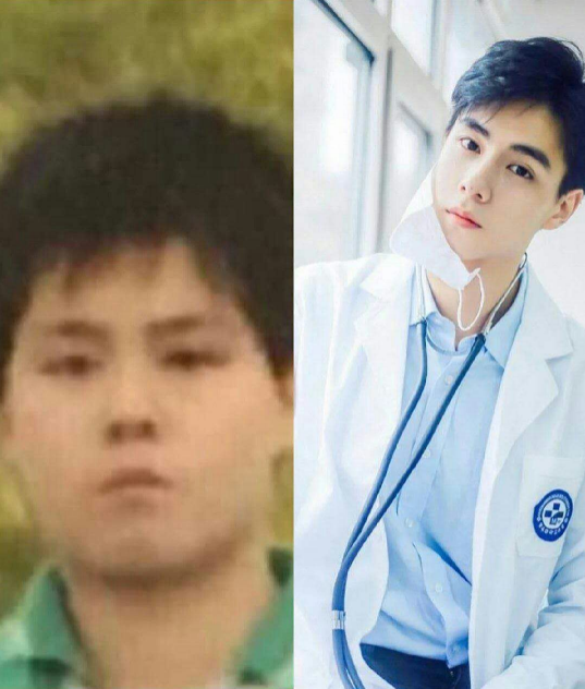 短发|减肥逆袭的最经典版本，蒋欣变瘦超美，李现瘦下来真的太帅了