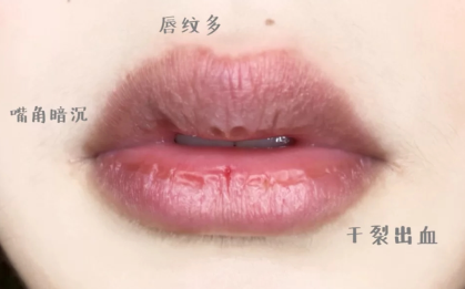 润唇膏 孕妇唇膏大盘点！嘴干起皮唇裂我只推荐这三款，拒绝猪油嘴