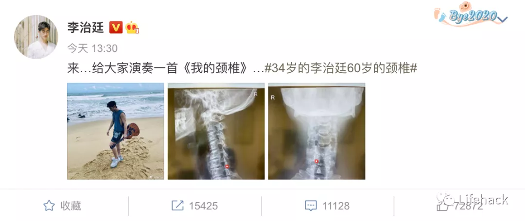 李治廷|34歲李治廷自爆頸椎已經60歲，網友：快別讓他自虐了