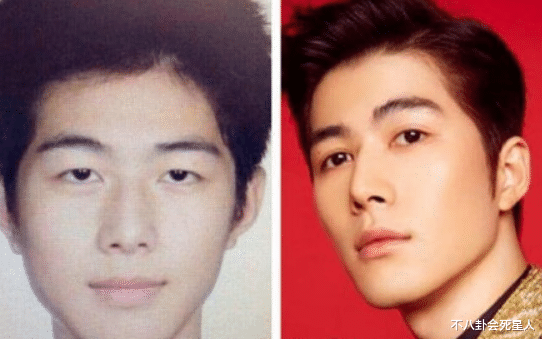 明星|对双眼皮“下手”的明星：浮肿、宽大、失败返工，一个比一个狠