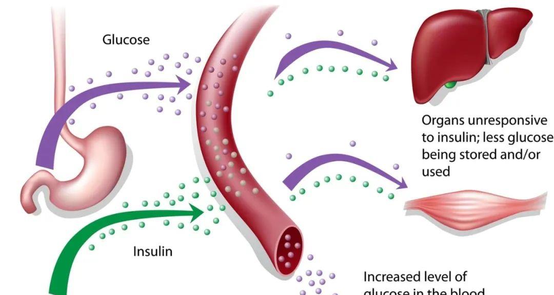 干细胞在糖尿病领域展望:MSCs到iPSCs,再生医学的自我颠覆之路