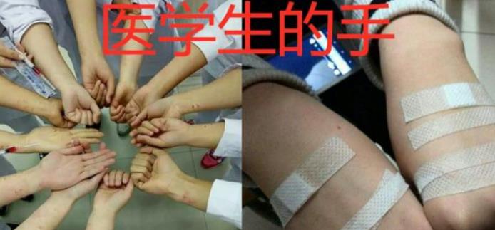 医学生|大一女医学生充分展现“初生牛犊不怕虎”，男同学们都避之不及
