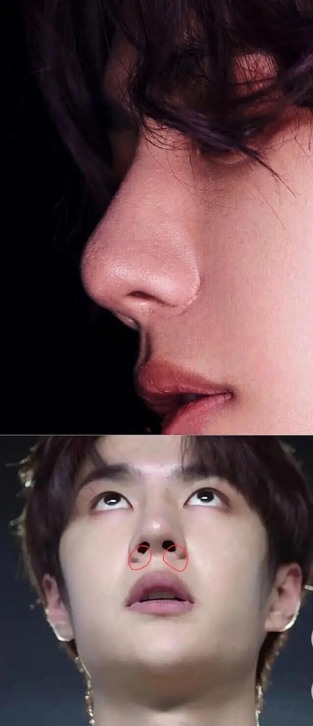 整容|内娱“假鼻子”大PK，谁的假到逆天，谁的越整越残？