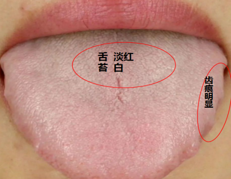 中药|脾虚湿盛？简单两味中药，日常泡水，一味健脾，一味祛湿