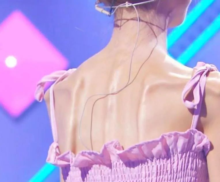 空腹|时隔3年，那个因为网恋从128斤瘦到58斤的“排骨妹”现状如何？