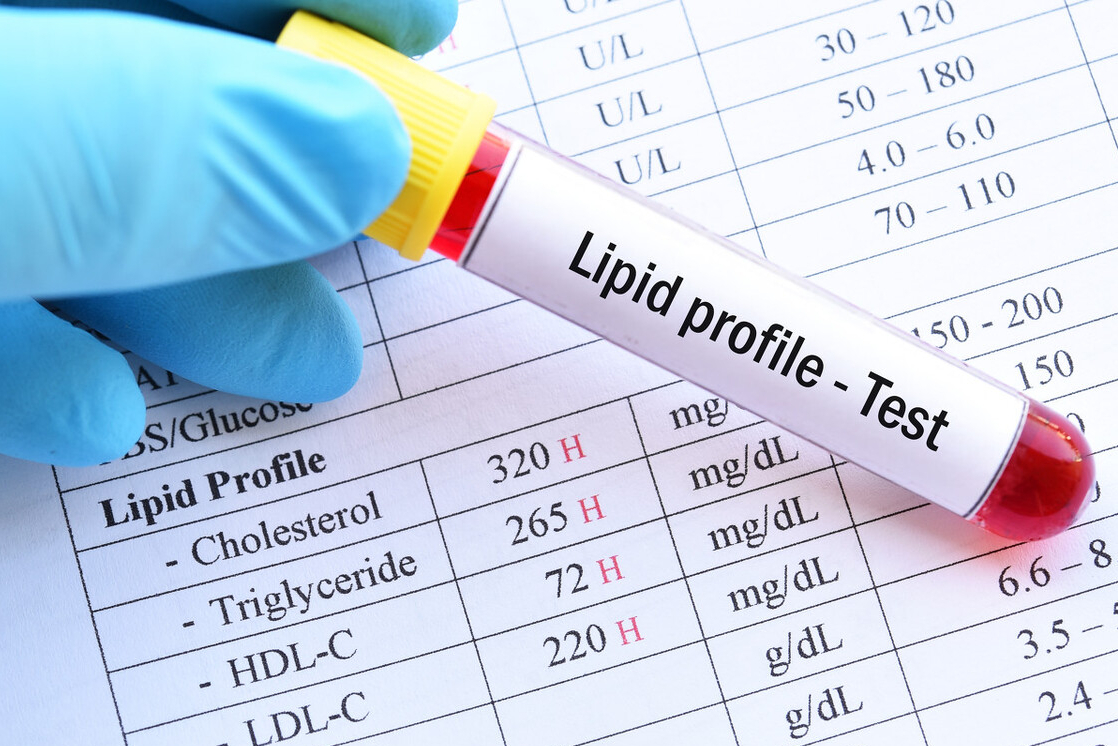 高血脂|高血脂的“克星”出现了，血脂高的人，没事多吃点，平衡血脂