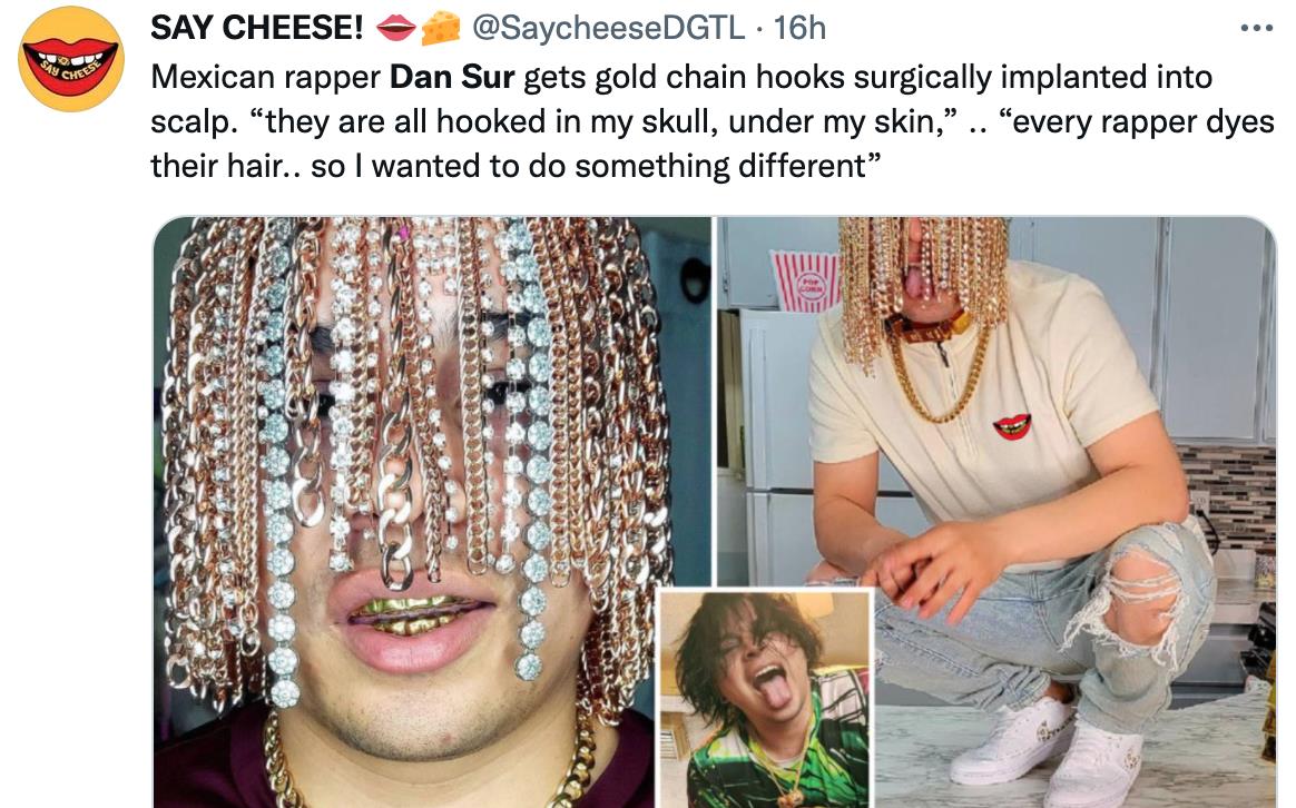 医生|脑门镶钻后，又有歌手钻开头骨植满大金链？网友嘲翻！