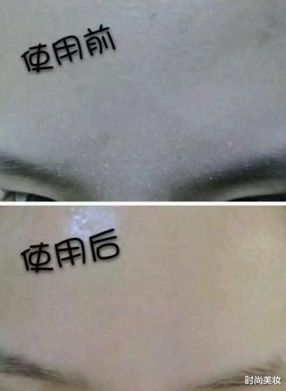 肖战|吴昕“整容式护肤”有多厉害？“乡土”变“高端”年轻了不止5岁