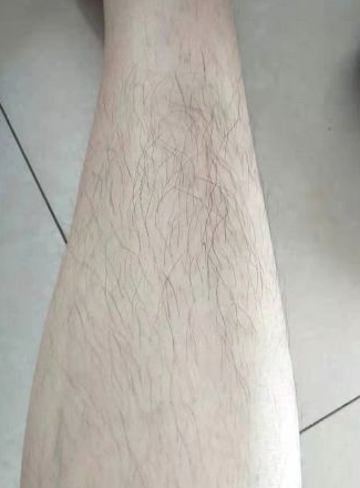 秀尚青依 二胎宝妈分享丨注意!孕期别盲目跟风网红身体乳,长毛还烂肤