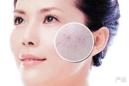 严选 我国一款“不起眼”洁面皂,净痘除螨洁净肌肤,却因低价不被重视