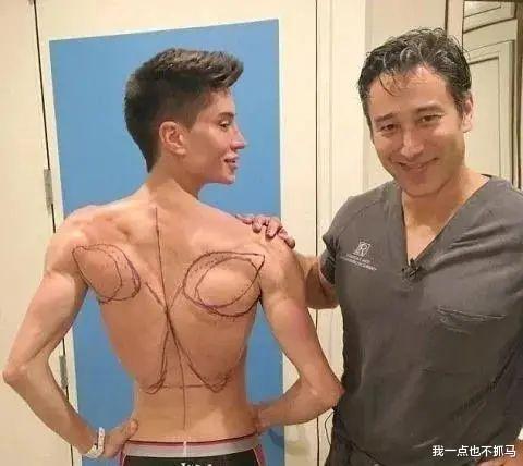 孙艺珍|10年花了「一千万整容」，他成为了「芭比真人男友」！