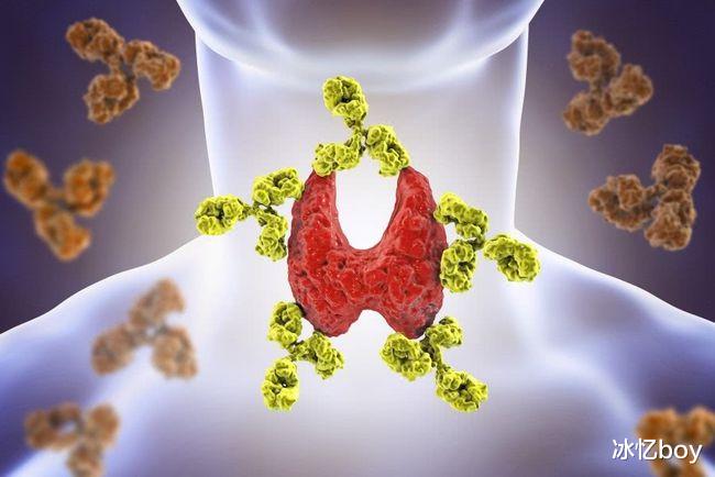 甲状腺结节|甲状腺结节不能吃海带?提醒:其实真正要忌口,是3种“素菜”