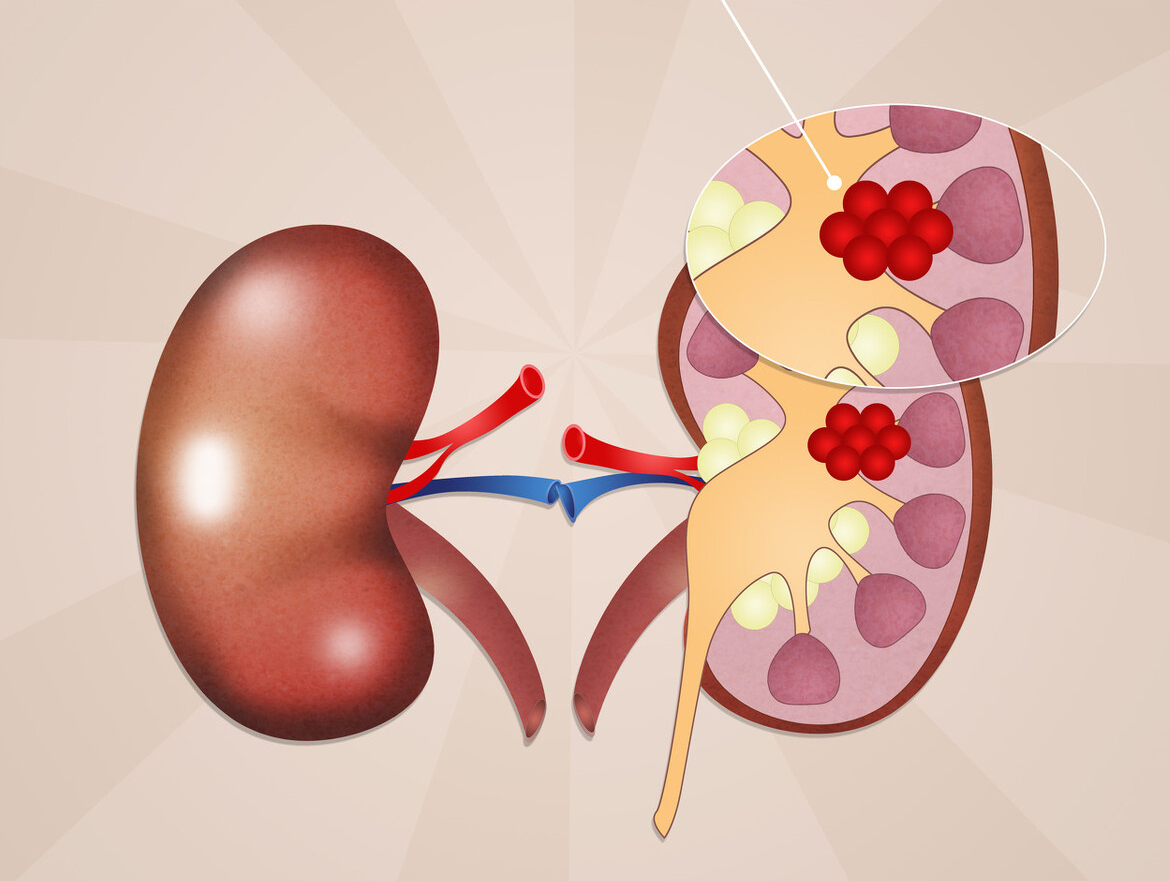 熬夜|秋天如何养肾?医生提醒:生活保持这几个习惯,肾会感激你