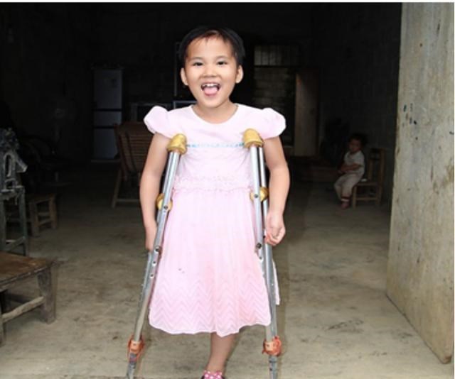 奶豆说育儿|河南独腿女孩罗雨因电焊走红，被300个单身小伙表白，皆一一回绝