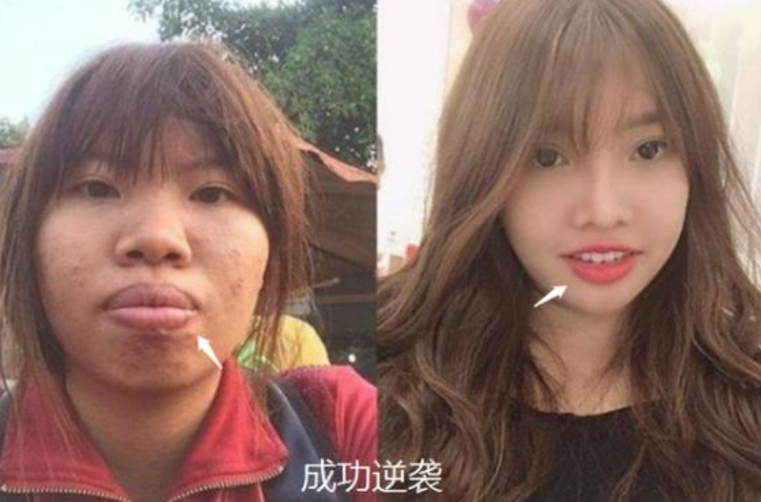 萱爸育儿经|26岁缅甸女孩整容成网红,嫁给富豪怀孕后原形毕露,堪称判若两人