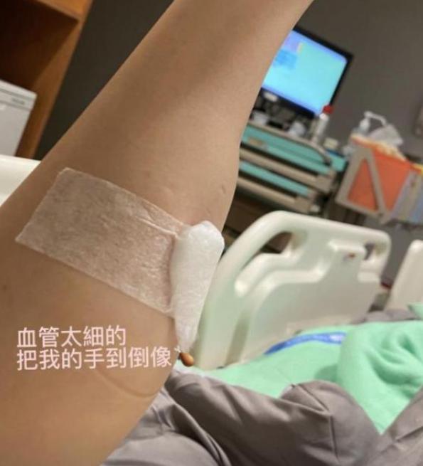 陈乔恩|是滤镜还是整容？42岁陈乔恩病愈后晒自拍，下巴变化太明显遭质疑