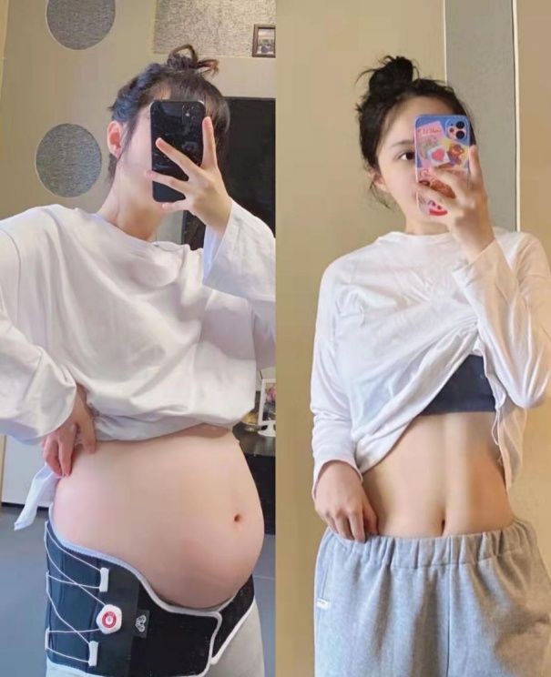 妊娠纹 怀孕产后一样美！超详细孕期食谱+专业锻炼法！分享孕期变美秘籍