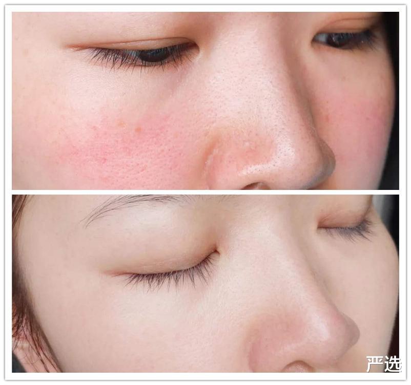 严选|女星的3种美白方式,特别容易“烂脸”损伤肌肤,你都用过哪个?
