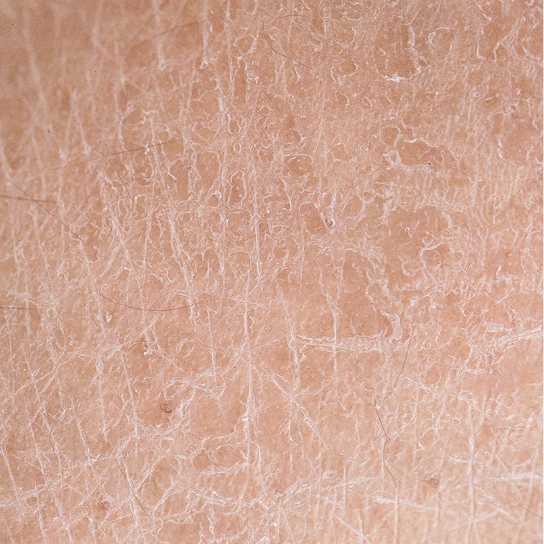 彬彬OK仔 ?一到换季皮肤差？皮肤的这些需求你要看懂了！