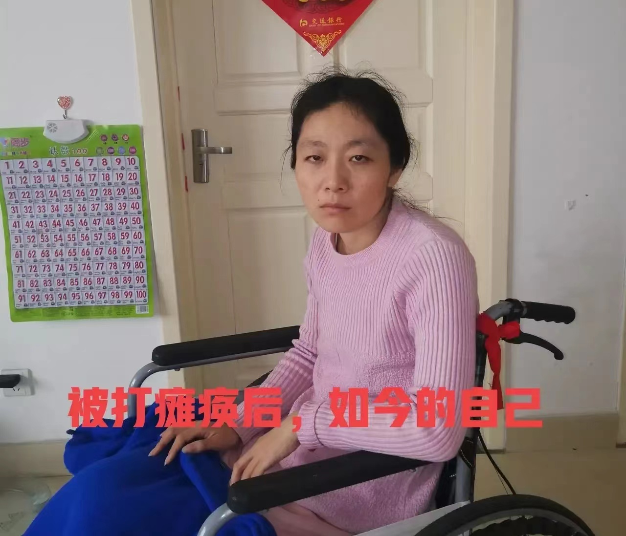 山东女子被丈夫和婆婆家暴致残,女子双腿萎缩,丈夫在她孕期变心