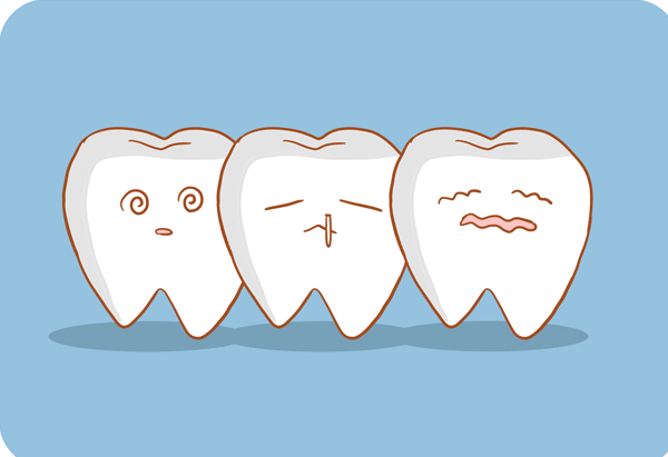 运动|牙科X光真的很有用！