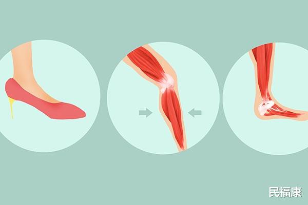 运动|女性朋友膝盖“坏”的快？或与5个因素有关，要谨防