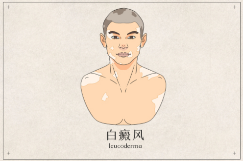 |一场意外的空袭和氮芥的发现