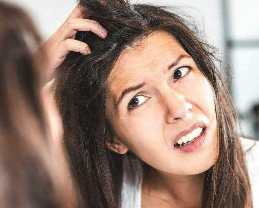 洗发水|三种被拉入“黑名单”的洗发水，起屑出油还掉发，不少人仍在使用