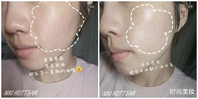 时尚美妆|孙艺珍的素颜照惊艳到我了！皮肤嫩得掐出水，旁边的素人好吃亏