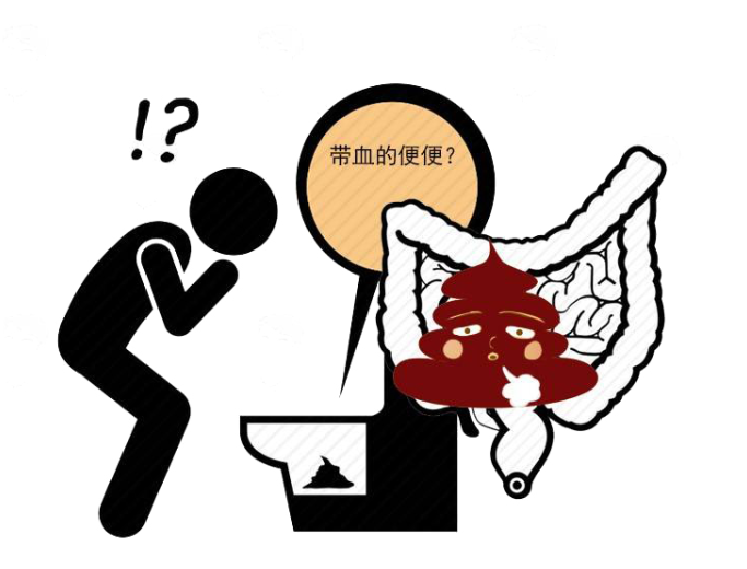 排便|肠道是否癌变？上厕所时瞅一眼就知道答案，3个异常，希望你别占