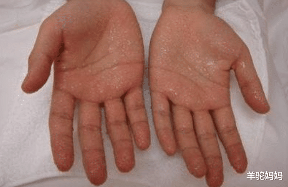 羊驼妈妈|“脾胃虚”的宝宝，身上这2个部位经常出汗，父母早了解娃早受益