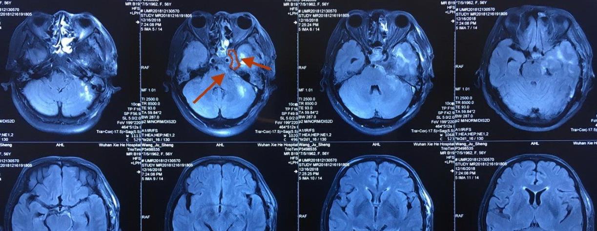 配音 为什么“磁共振”尽量不要做？或许你还不明白，与这3点有关系