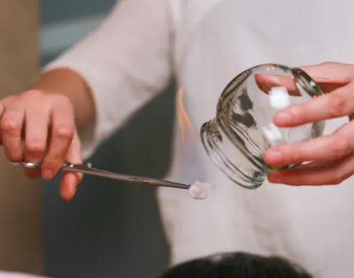 |胡博士说中医｜拔罐又火了，为什么运动员热衷于拔罐？