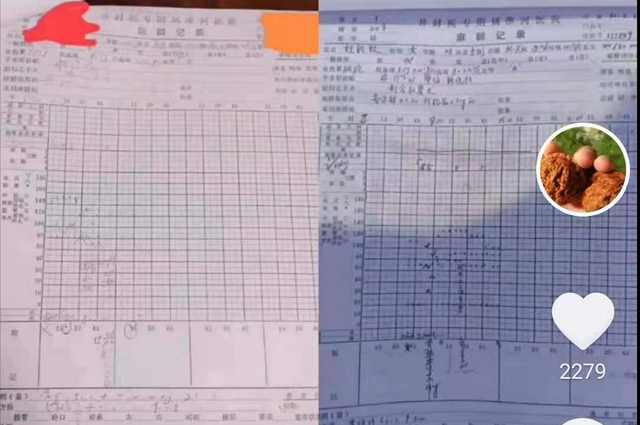 若珍|郭威错换案：涂改麻醉单被“实锤”，为何单据上没有医生的签字？