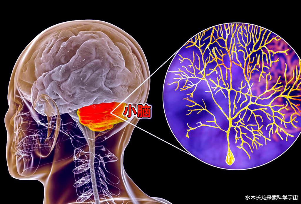 科学家 科学常理难以解释的现象：人失去小脑后仍能正常生活三十多年
