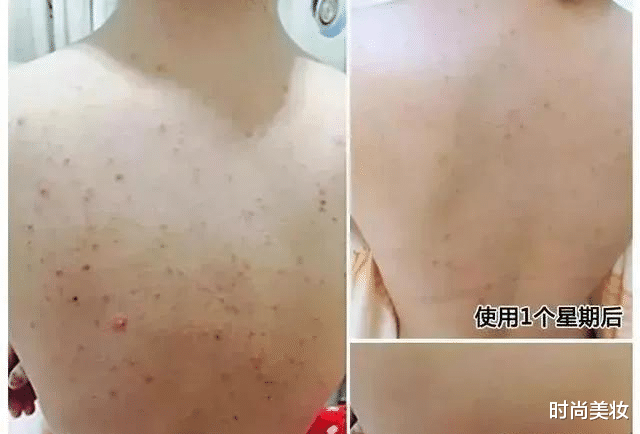 时尚美妆|54岁巩俐和71岁丈夫又火了！皮肤更紧致了，网友：无美颜肌肤超嫩