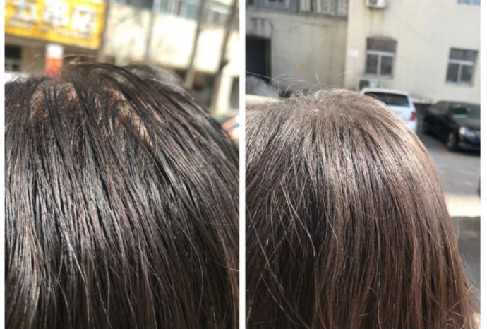 保湿|孕期需要更换洗发水？盘点4款口碑不错的孕妇洗发水，控油又保湿