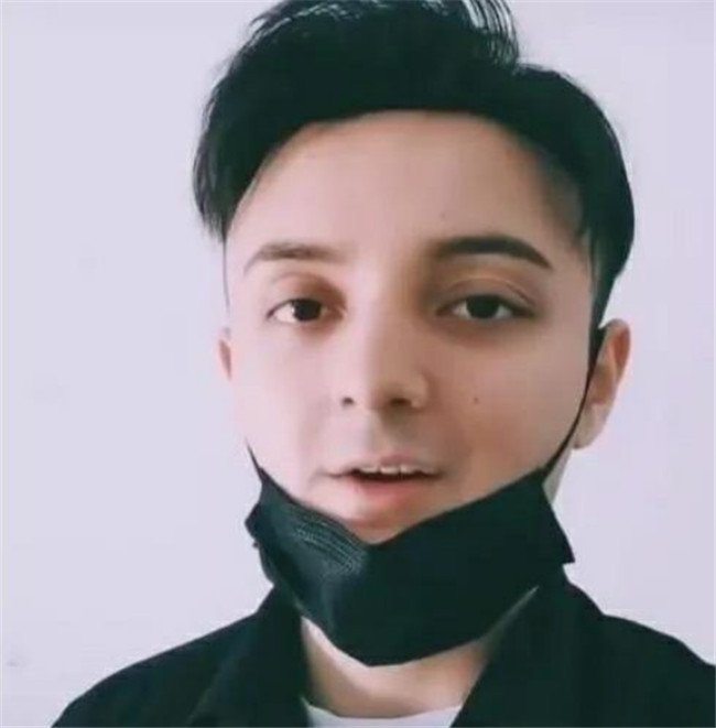 阿尔法|国民童星阿尔法，5岁爆红20岁秃顶像大叔，如今成功逆袭成男神